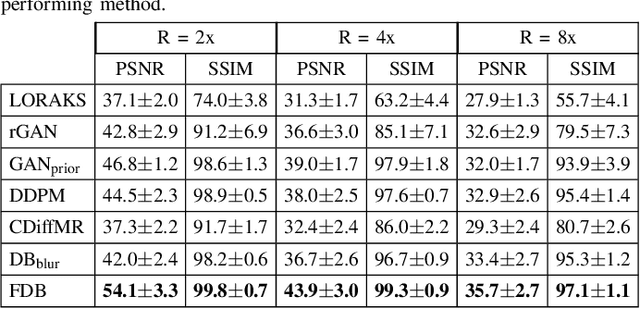 Figure 4 for Learning Fourier-Constrained Diffusion Bridges for MRI Reconstruction