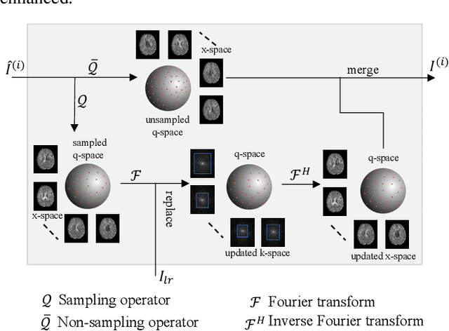 Figure 2 for Spatial-Angular Representation Learning for High-Fidelity Continuous Super-Resolution in Diffusion MRI