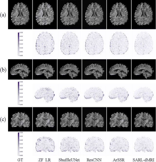 Figure 3 for Spatial-Angular Representation Learning for High-Fidelity Continuous Super-Resolution in Diffusion MRI