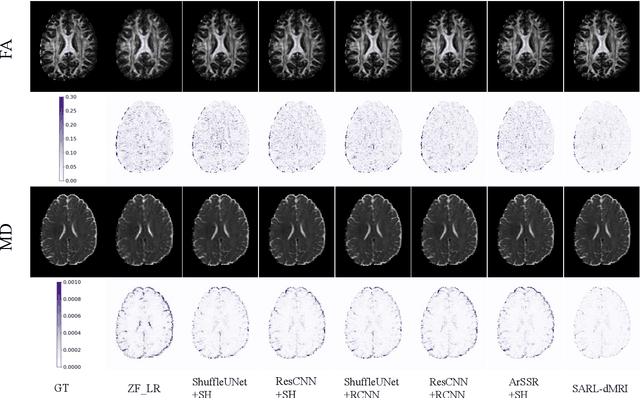 Figure 4 for Spatial-Angular Representation Learning for High-Fidelity Continuous Super-Resolution in Diffusion MRI