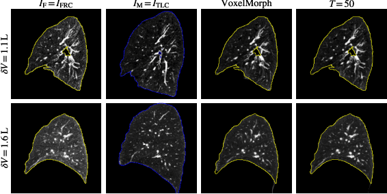 Figure 3 for Uncertainty-Aware Test-Time Adaptation for Inverse Consistent Diffeomorphic Lung Image Registration