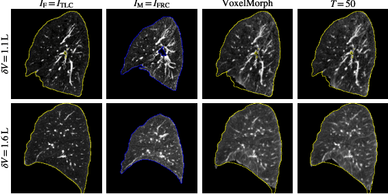 Figure 4 for Uncertainty-Aware Test-Time Adaptation for Inverse Consistent Diffeomorphic Lung Image Registration
