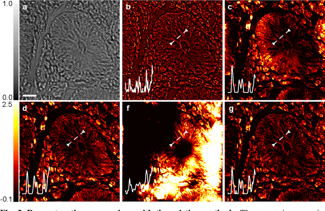 Figure 3 for Generalizable Holographic Reconstruction via Amplitude-Only Diffusion Priors