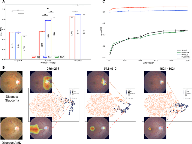 Figure 3 for A Disease-Specific Foundation Model Using Over 100K Fundus Images: Release and Validation for Abnormality and Multi-Disease Classification on Downstream Tasks