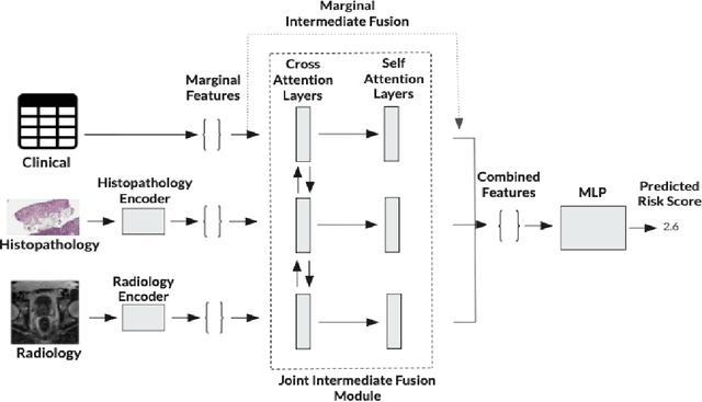 Figure 1 for Synergy vs. Noise: Performance-Guided Multimodal Fusion For Biochemical Recurrence-Free Survival in Prostate Cancer