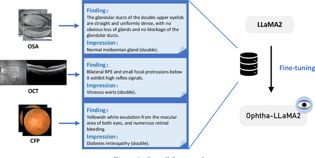 Figure 4 for Ophtha-LLaMA2: A Large Language Model for Ophthalmology