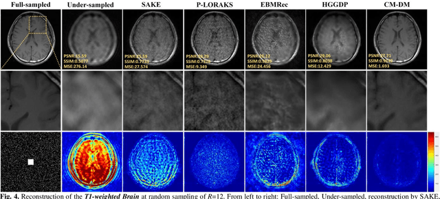 Figure 4 for Correlated and Multi-frequency Diffusion Modeling for Highly Under-sampled MRI Reconstruction