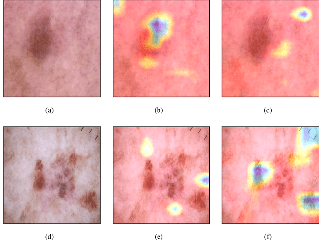 Figure 4 for Explainable Image Similarity: Integrating Siamese Networks and Grad-CAM