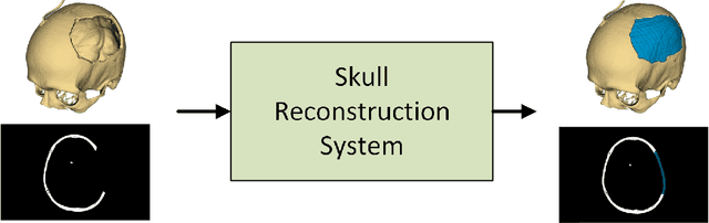 Figure 1 for Improving Deep Learning-based Automatic Cranial Defect Reconstruction by Heavy Data Augmentation: From Image Registration to Latent Diffusion Models