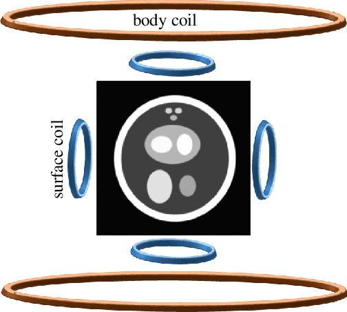 Figure 2 for Surface Coil Intensity Correction for MRI