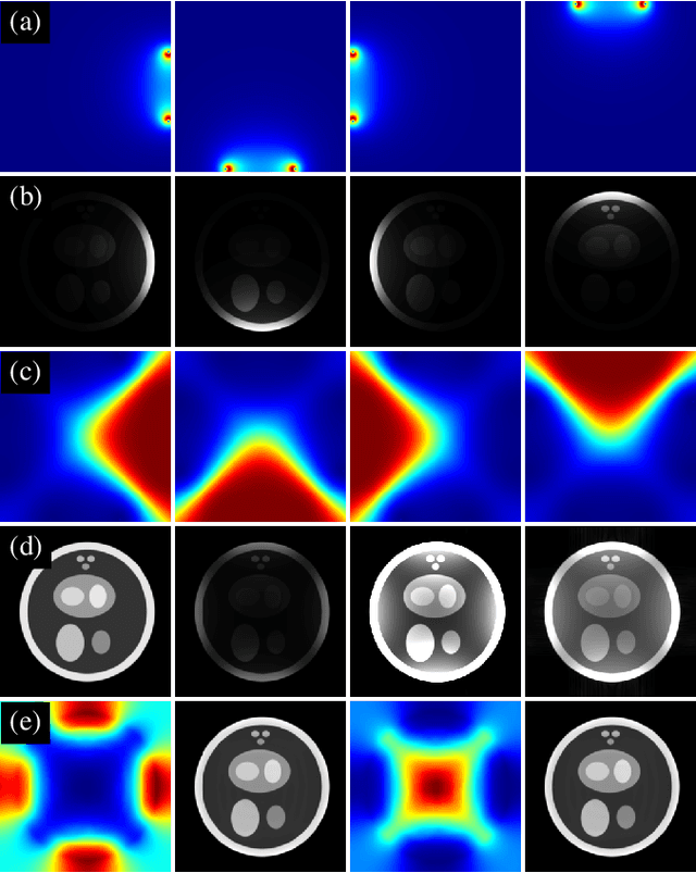 Figure 3 for Surface Coil Intensity Correction for MRI
