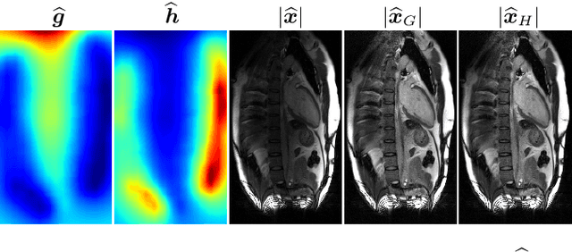 Figure 4 for Surface Coil Intensity Correction for MRI