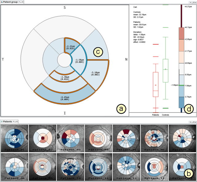 Figure 2 for Visual Analytics for Early Detection of Retinal Diseases