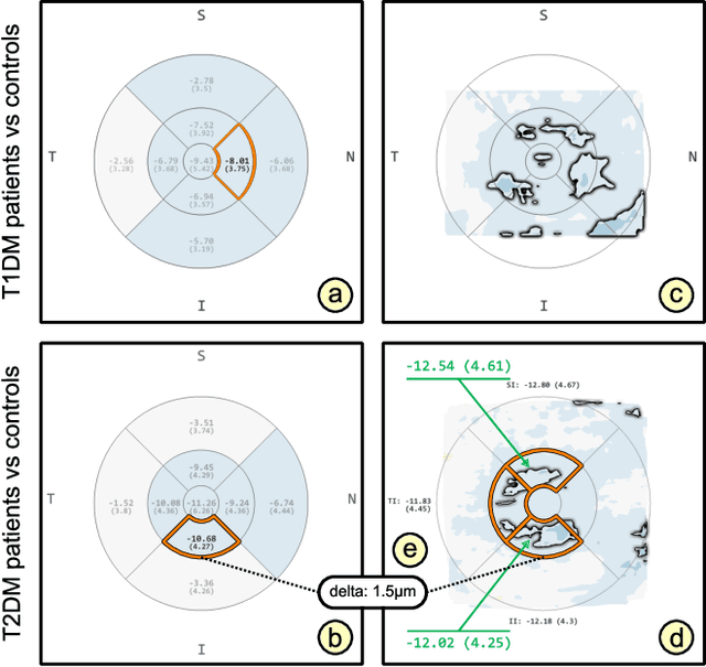 Figure 4 for Visual Analytics for Early Detection of Retinal Diseases