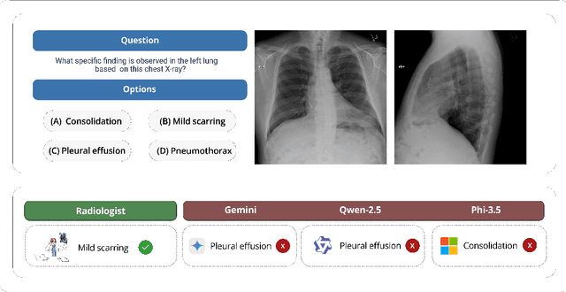 Figure 1 for ReXVQA: A Large-scale Visual Question Answering Benchmark for Generalist Chest X-ray Understanding