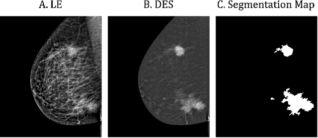 Figure 1 for Lesion-Aware Generative Artificial Intelligence for Virtual Contrast-Enhanced Mammography in Breast Cancer