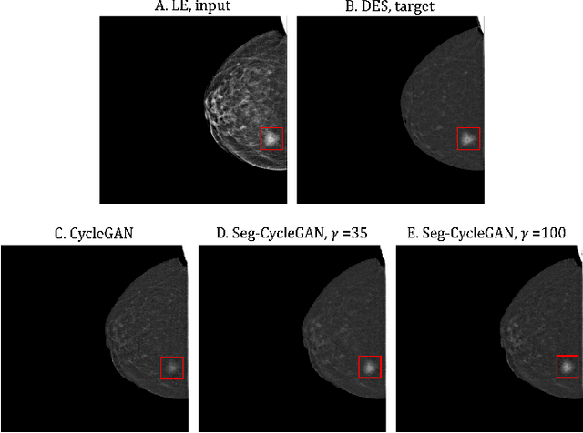 Figure 3 for Lesion-Aware Generative Artificial Intelligence for Virtual Contrast-Enhanced Mammography in Breast Cancer