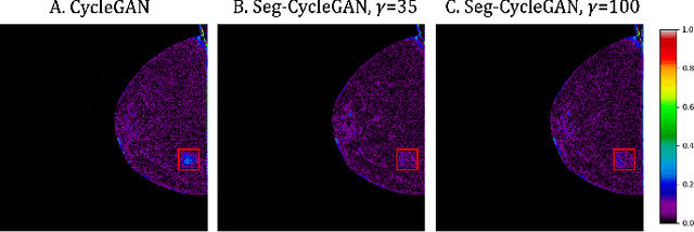 Figure 4 for Lesion-Aware Generative Artificial Intelligence for Virtual Contrast-Enhanced Mammography in Breast Cancer