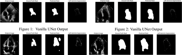 Figure 1 for Latents of latents to delineate pixels: hybrid Matryoshka autoencoder-to-U-Net pairing for segmenting large medical images in GPU-poor and low-data regimes