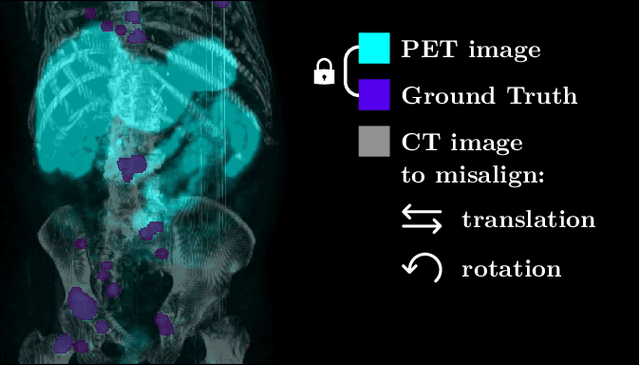 Figure 1 for Data-Centric Strategies for Overcoming PET/CT Heterogeneity: Insights from the AutoPET III Lesion Segmentation Challenge
