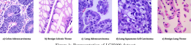Figure 1 for Exploring Explainable AI Techniques for Improved Interpretability in Lung and Colon Cancer Classification