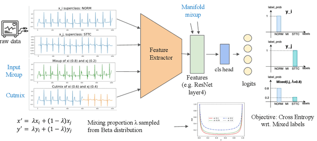Figure 1 for Empirical Study of Mix-based Data Augmentation Methods in Physiological Time Series Data