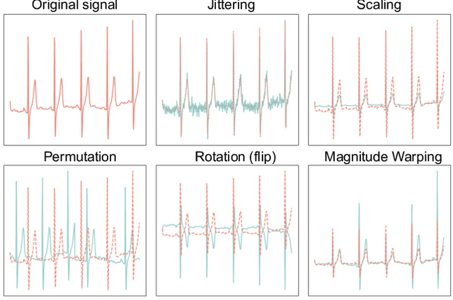 Figure 2 for Empirical Study of Mix-based Data Augmentation Methods in Physiological Time Series Data