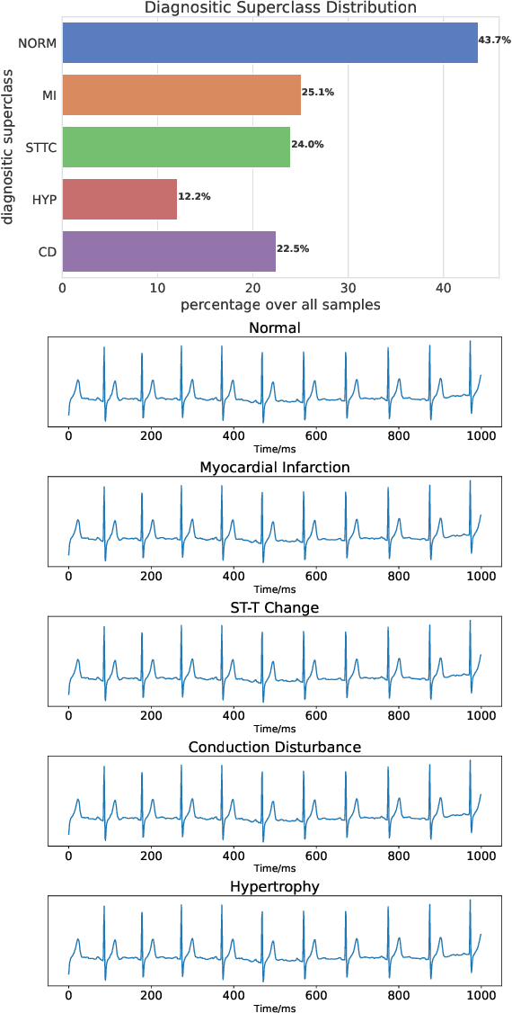 Figure 3 for Empirical Study of Mix-based Data Augmentation Methods in Physiological Time Series Data