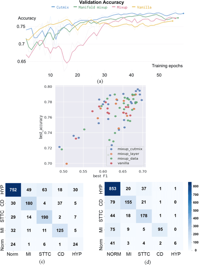 Figure 4 for Empirical Study of Mix-based Data Augmentation Methods in Physiological Time Series Data