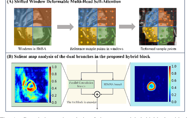 Figure 1 for Swin Deformable Attention Hybrid U-Net for Medical Image Segmentation