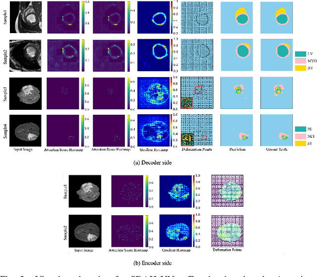 Figure 3 for Swin Deformable Attention Hybrid U-Net for Medical Image Segmentation