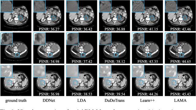 Figure 3 for Learned Alternating Minimization Algorithm for Dual-domain Sparse-View CT Reconstruction
