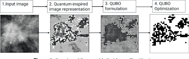 Figure 1 for Quantum-enhanced unsupervised image segmentation for medical images analysis