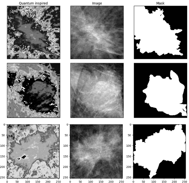 Figure 3 for Quantum-enhanced unsupervised image segmentation for medical images analysis