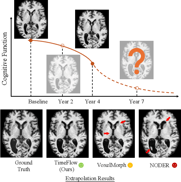 Figure 1 for TimeFlow: Longitudinal Brain Image Registration and Aging Progression Analysis