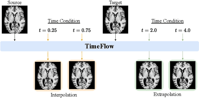 Figure 2 for TimeFlow: Longitudinal Brain Image Registration and Aging Progression Analysis