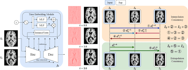 Figure 3 for TimeFlow: Longitudinal Brain Image Registration and Aging Progression Analysis
