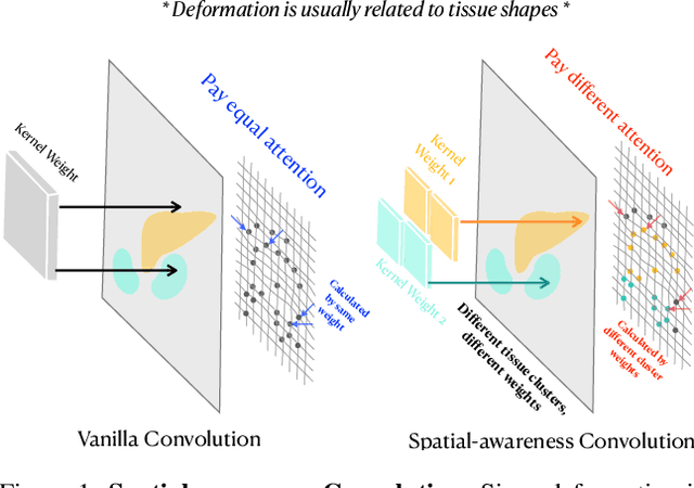 Figure 1 for SACB-Net: Spatial-awareness Convolutions for Medical Image Registration