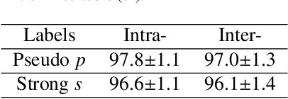 Figure 2 for Beyond Strong labels: Weakly-supervised Learning Based on Gaussian Pseudo Labels for The Segmentation of Ellipse-like Vascular Structures in Non-contrast CTs