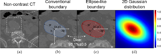 Figure 1 for Beyond Strong labels: Weakly-supervised Learning Based on Gaussian Pseudo Labels for The Segmentation of Ellipse-like Vascular Structures in Non-contrast CTs