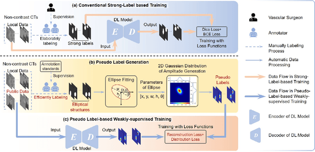 Figure 3 for Beyond Strong labels: Weakly-supervised Learning Based on Gaussian Pseudo Labels for The Segmentation of Ellipse-like Vascular Structures in Non-contrast CTs