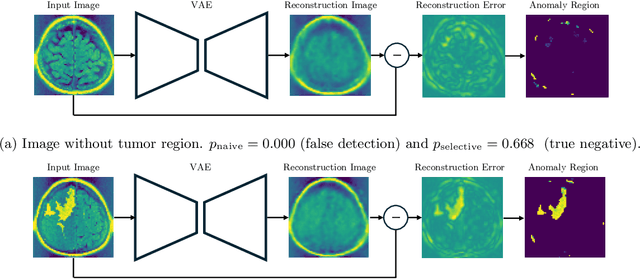 Figure 1 for Statistical Test for Anomaly Detections by Variational Auto-Encoders