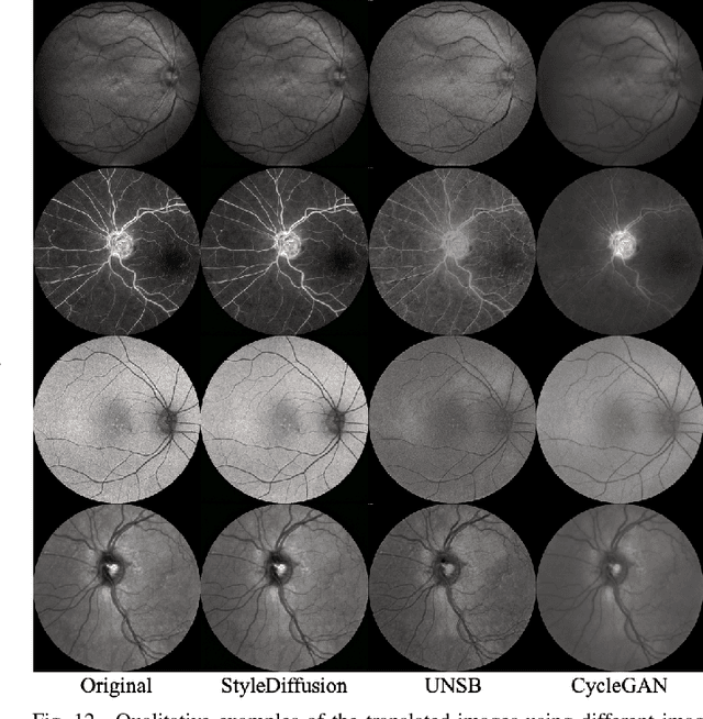 Figure 4 for Universal Vessel Segmentation for Multi-Modality Retinal Images