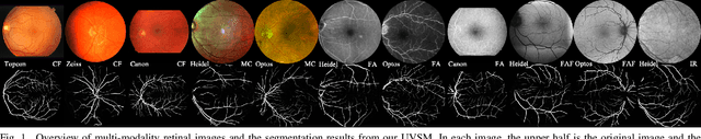 Figure 1 for Universal Vessel Segmentation for Multi-Modality Retinal Images