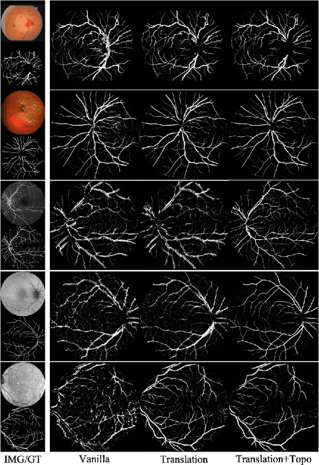 Figure 2 for Universal Vessel Segmentation for Multi-Modality Retinal Images