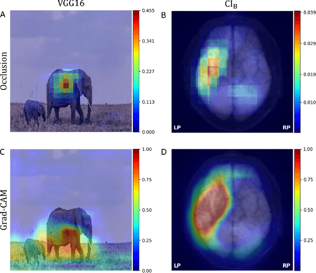 Figure 1 for Going beyond explainability in multi-modal stroke outcome prediction models