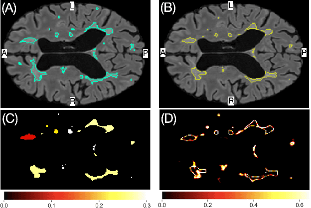 Figure 1 for Novel structural-scale uncertainty measures and error retention curves: application to multiple sclerosis