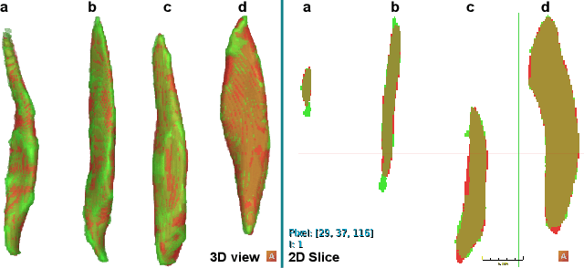 Figure 4 for Unsupervised Anomaly Detection on Implicit Shape representations for Sarcopenia Detection