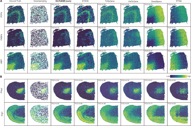 Figure 2 for High-Resolution Spatial Transcriptomics from Histology Images using HisToSGE