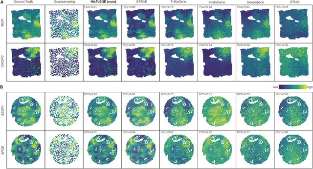 Figure 3 for High-Resolution Spatial Transcriptomics from Histology Images using HisToSGE